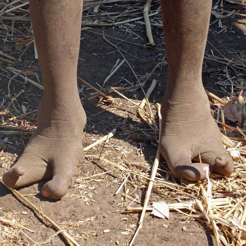 pies-avestruz Enigmática tribu de Vadoma, la tribu de los "Pies de Avestruz"